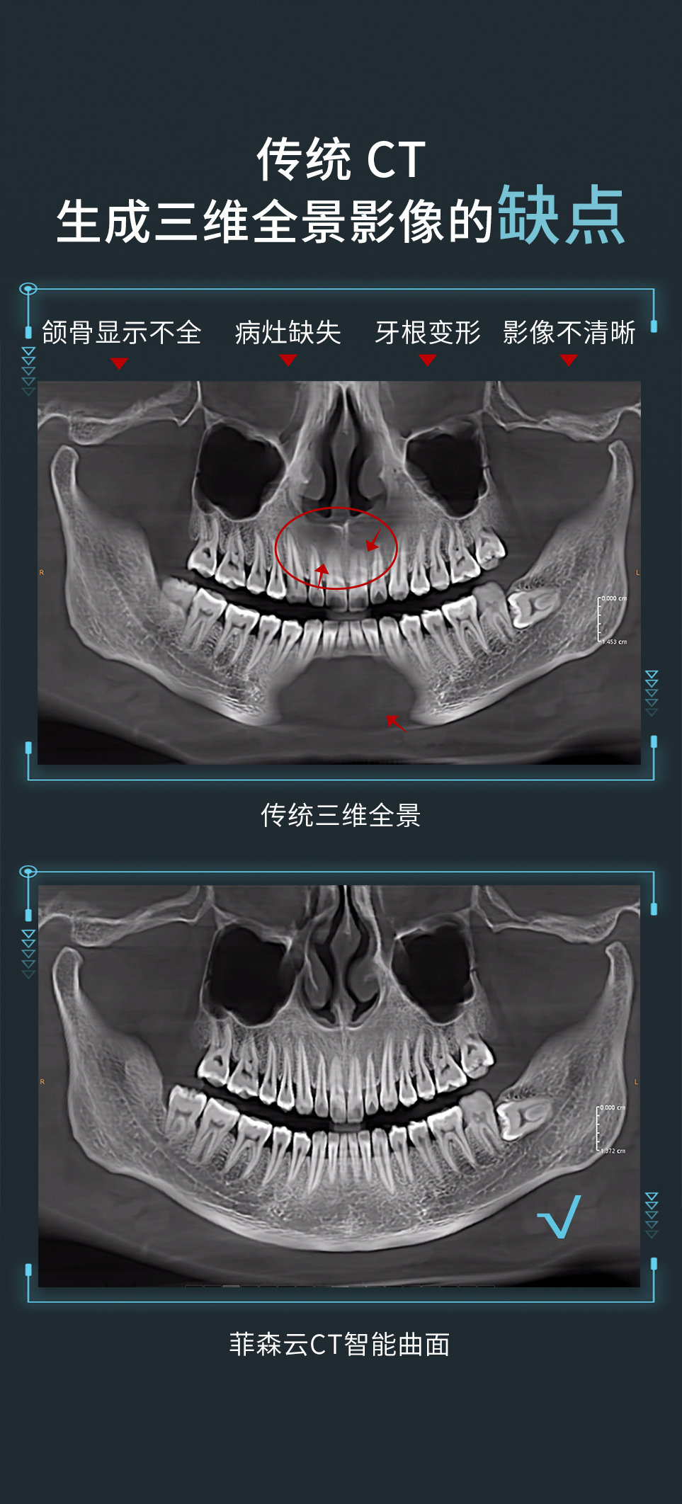 CT智能曲面头图_03