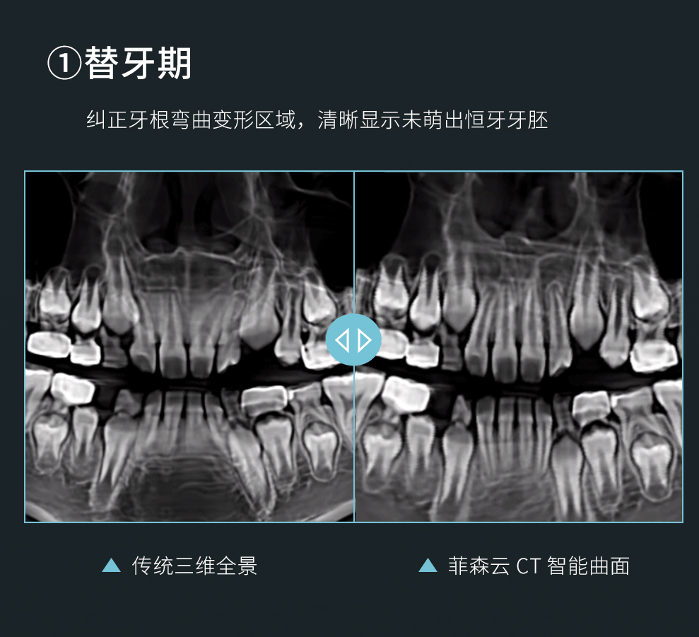 CT智能曲面头图_08