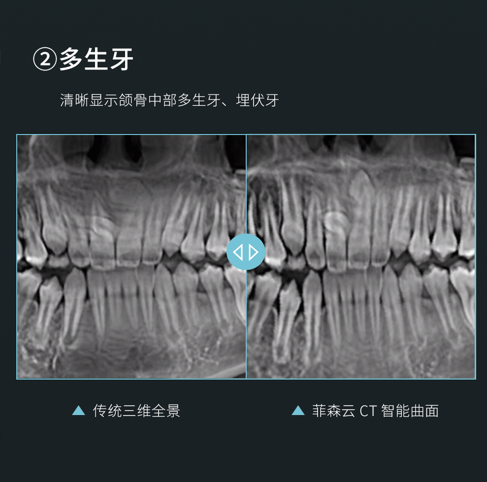 CT智能曲面头图_09