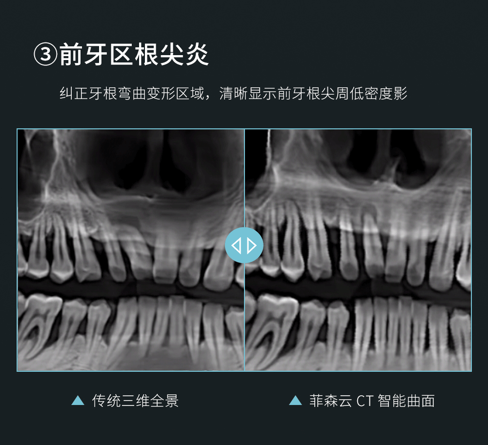 CT智能曲面头图_10