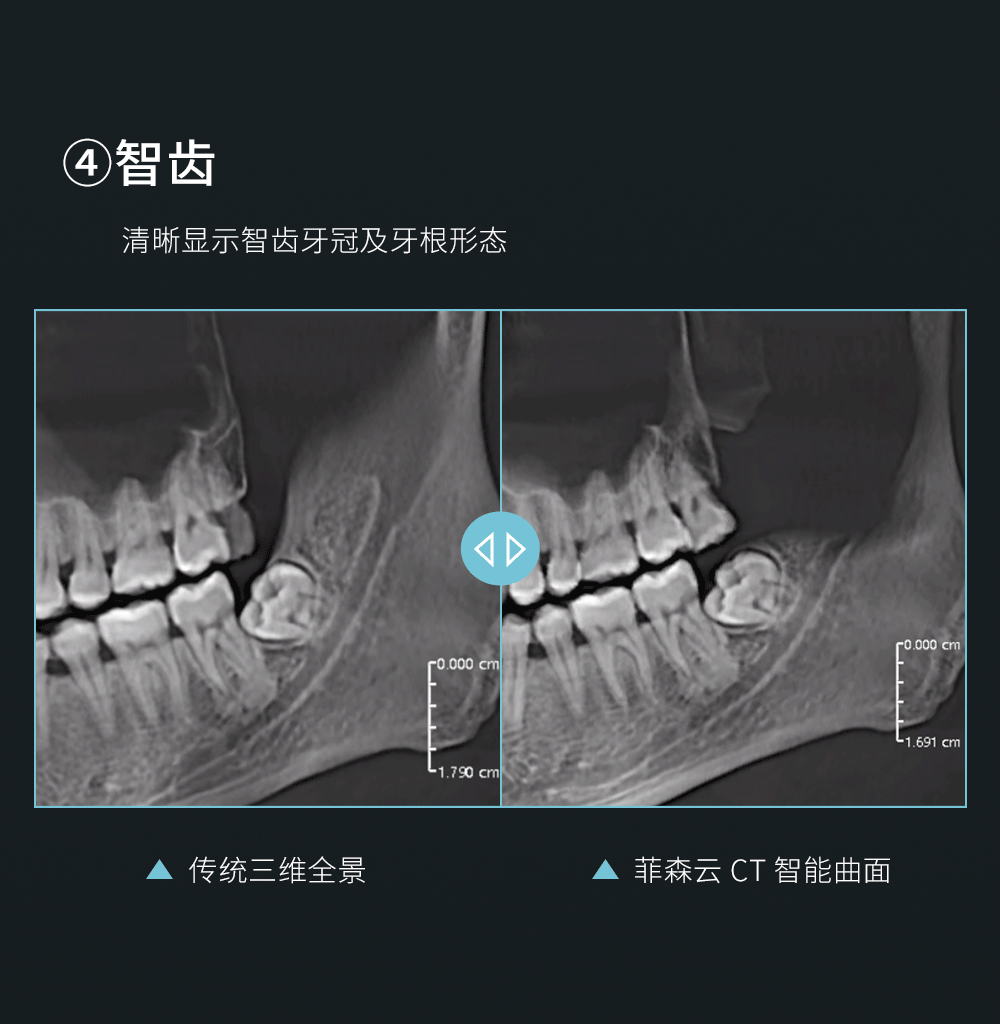 CT智能曲面头图_11