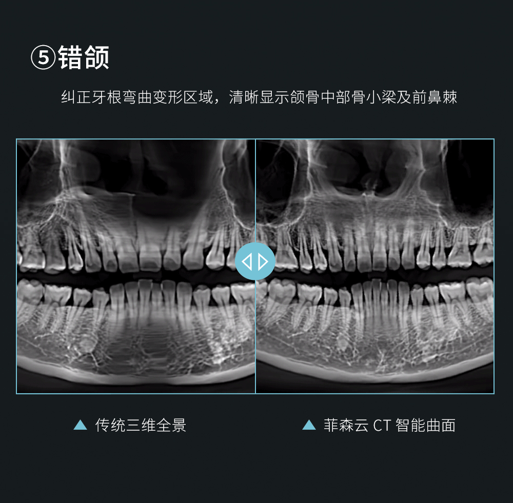 CT智能曲面头图_12