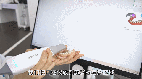 口扫1