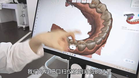 口扫5
